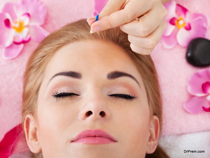 Woman Getting Acupuncture Treatment