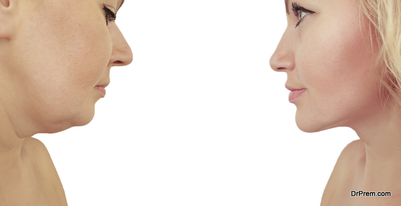get-rid-of-face-fat-naturally