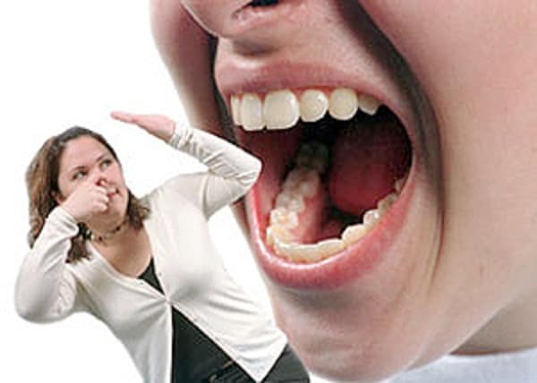 tips_to_get_rid_of_bad_breath - Dr Prem