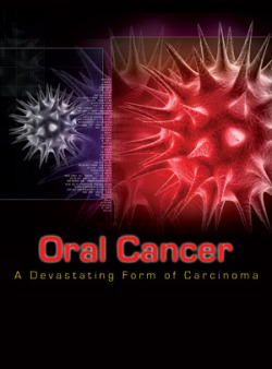 Oral Cancer