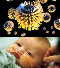 Understand Common Childhood Disease- Rotavirus