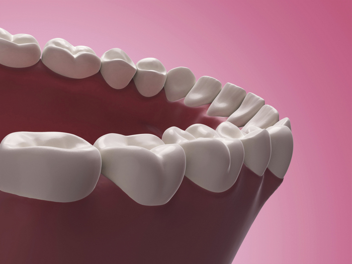 How Many Types of Gum Disease are There? Global Healthcare Guide