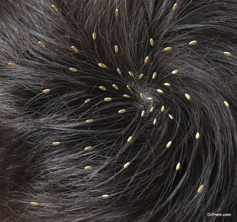 Close Up Of Someone S Head Infested With Head Lice Global Healthcare Guide Magazine And