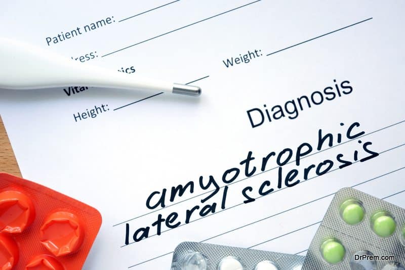 Amyotrophic-lateral-sclerotic