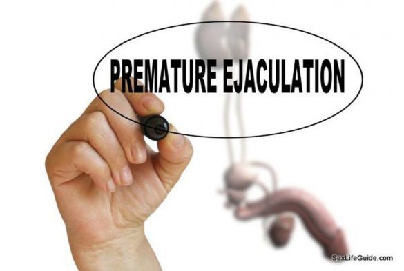 Facts And Figures Causes And Treatments Here Is All You Need To Know About Premature Ejaculation 