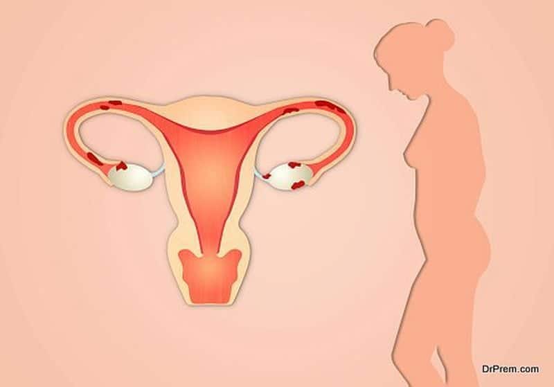 women reproductive health