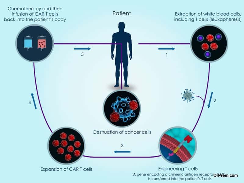 CAR T cell immunotherapies for children A pathbreaking