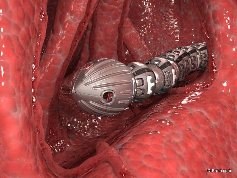 nanorobots inserted in the blood vessels