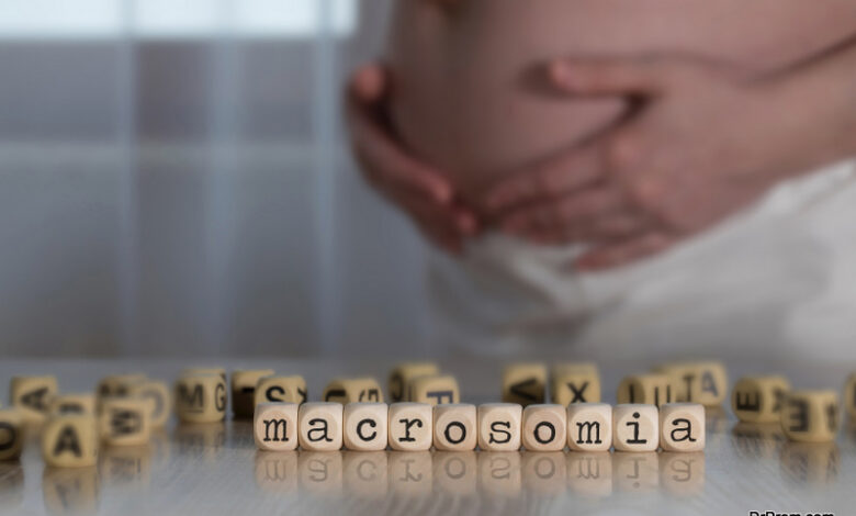 5 Facts about Macrosomia - Dr Prem's Life Improving Guide