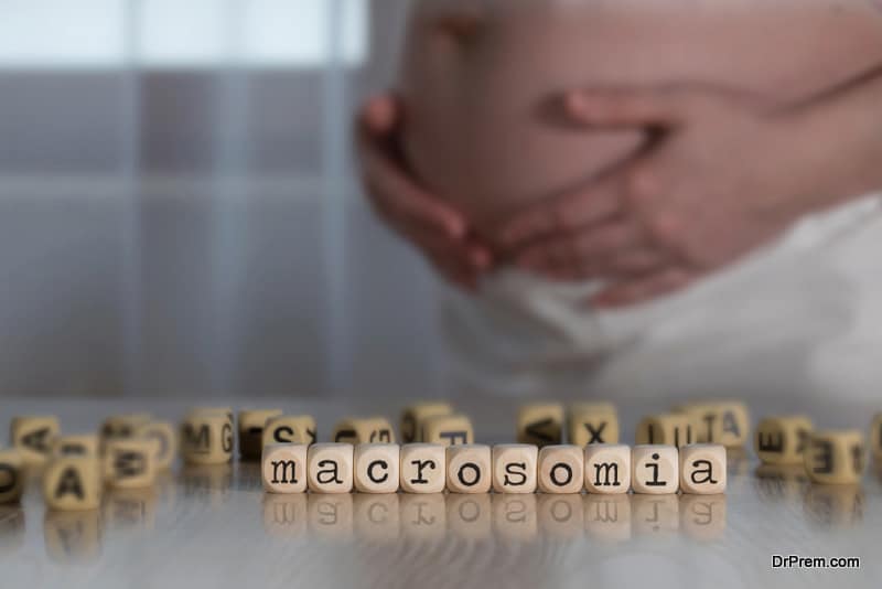 Facts about Macrosomia