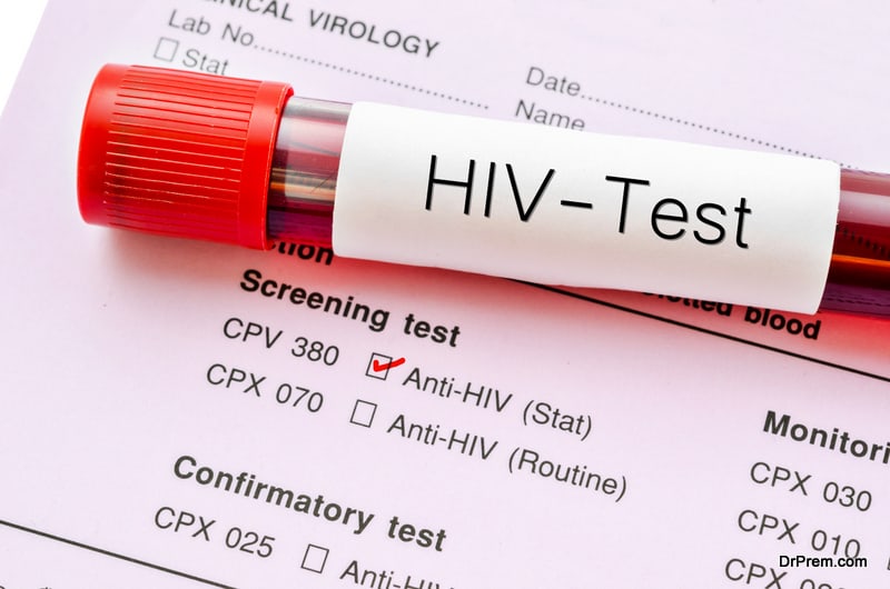 HIV test