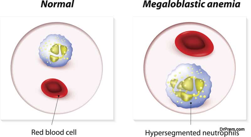 Tests for the sickle cell gene