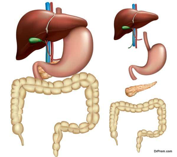 Colorectal Cancer 