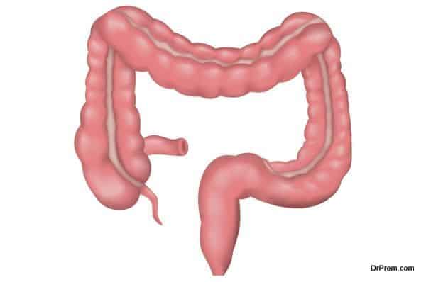 Pandrug resistant Klebsiella pneumoniae