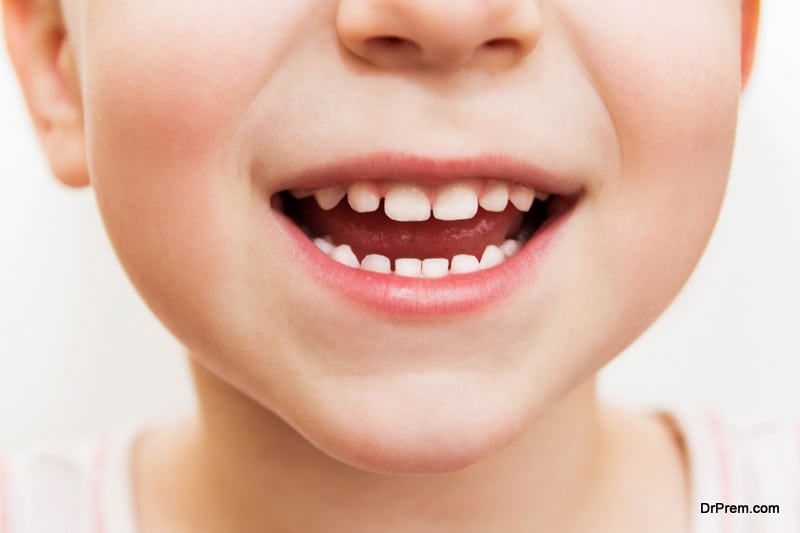 at-home teeth whitening for kids