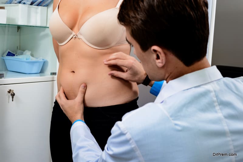 Practical consultation of the surgeon to remove excess fat in the abdomen