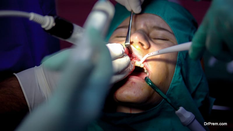 How to Avoid Complications After Oral Surgery