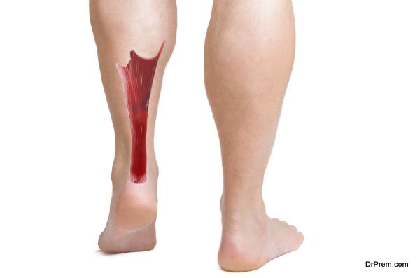 achilles tendon with lower leg muscles