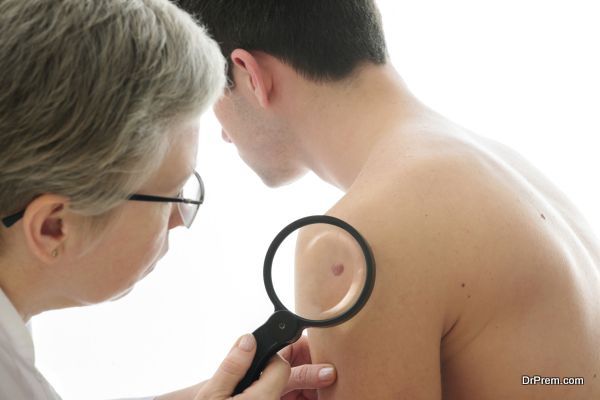 Dermatologist examines a mole