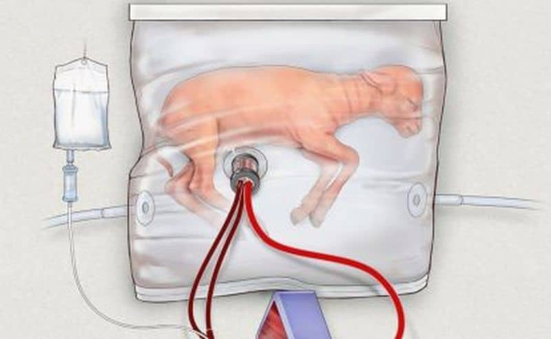  artificial-womb