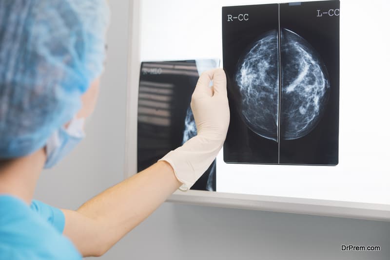 growing age augments the chances of developing the cancer symptoms