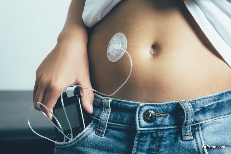 smart diabetes management technology