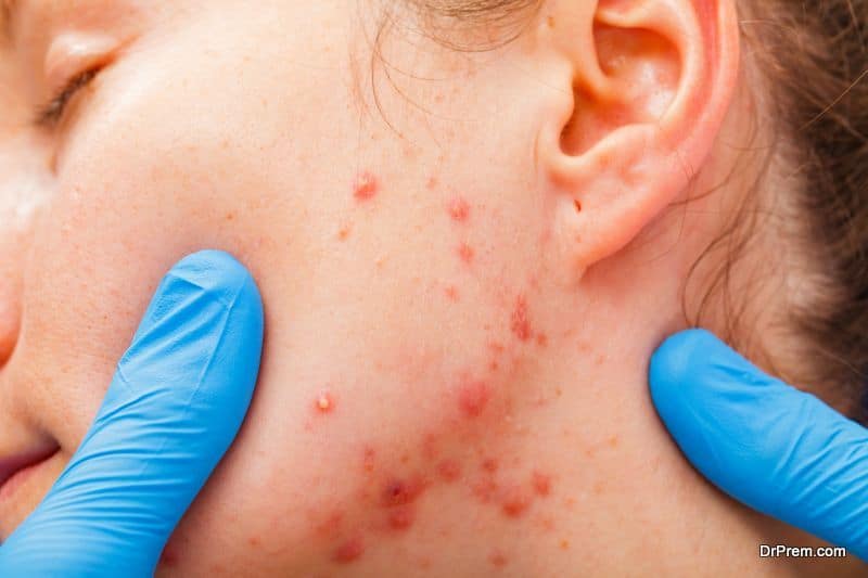 skin-infection