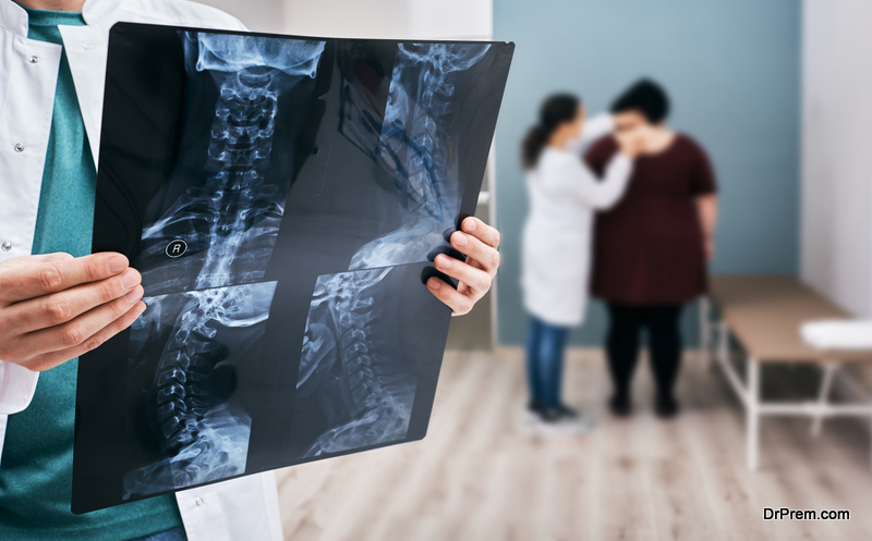 Doctor holds an x-ray of a cervical spine 