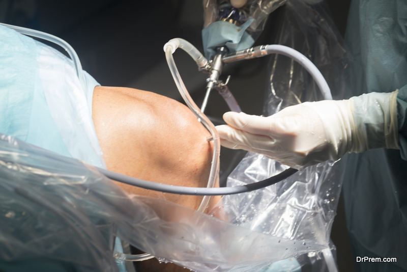 Knee keyhole surgery hospital arthroscopy operation medical procedure in emergency room operating theater