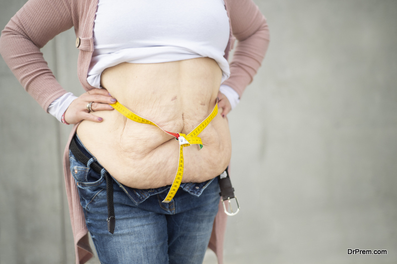 a-woman-has-lost-over-50-kg-weight-after-gastric-bypass