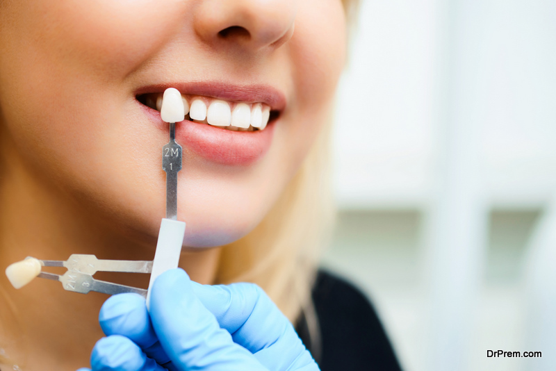 Matching the shades of the implants or the process of teeth whitening