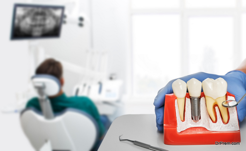 Doctor showing the installation of a dental implant on the anatomical model of teeth