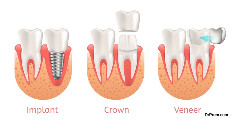 dental treatments