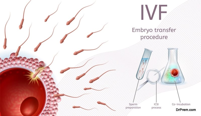 embryo transfer procedure