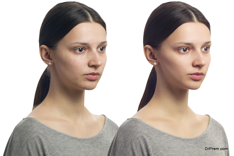 Retouch - face of beautiful young woman with problem skin on her face before and after. Isolated on white background