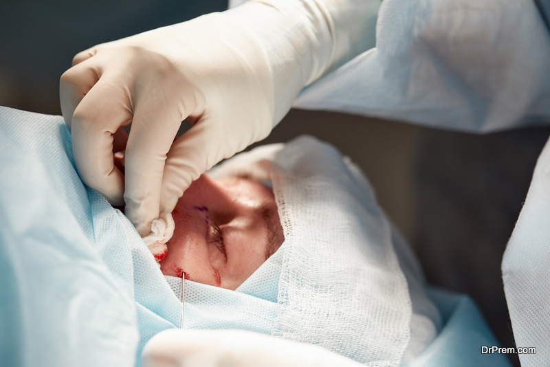 Close up of the face of a patient who is undergoing blepharoplasty