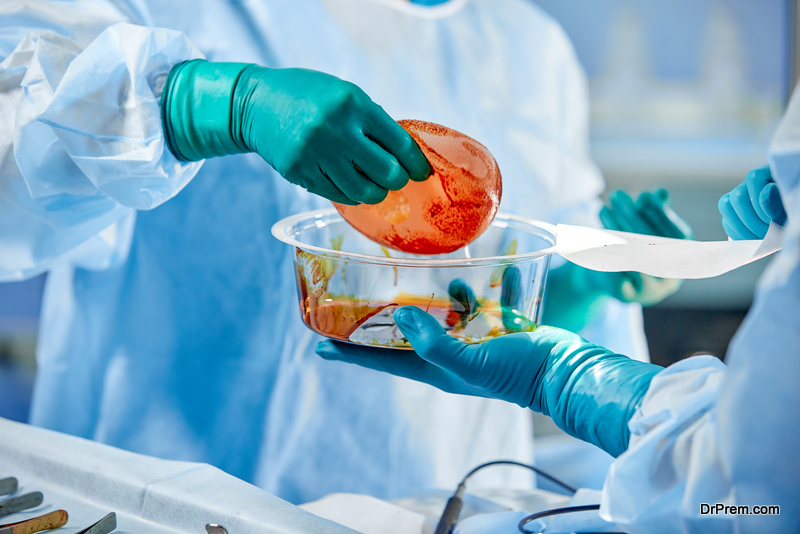 Doctor holding silicone implants for breast augmentation in clinic, closeup. Cosmetic surgery