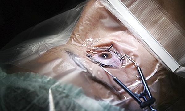 A patient undergoes an eye operation