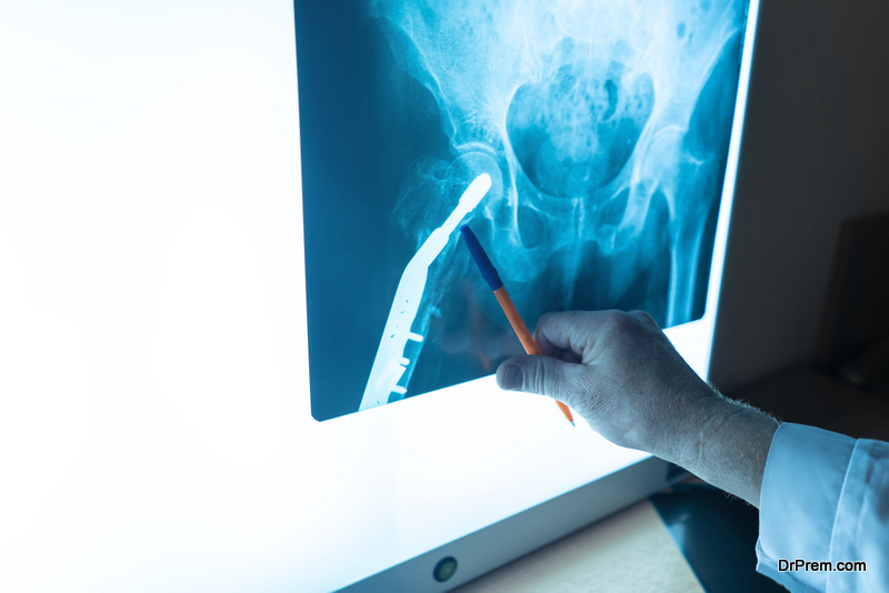 Medical workers in hospital examine x-ray prints