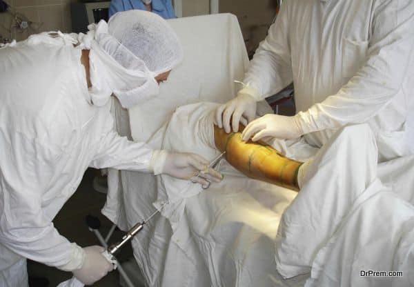 Surgeons and patient's leg. Moment of inserting the needles