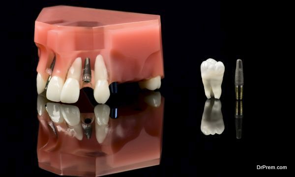 Real Human Wisdom tooth, Dental Titanium Implant and Plastic teeth model