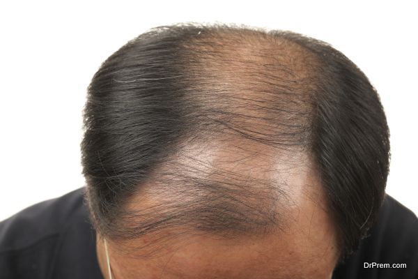 Hair Transplant destinations (6)