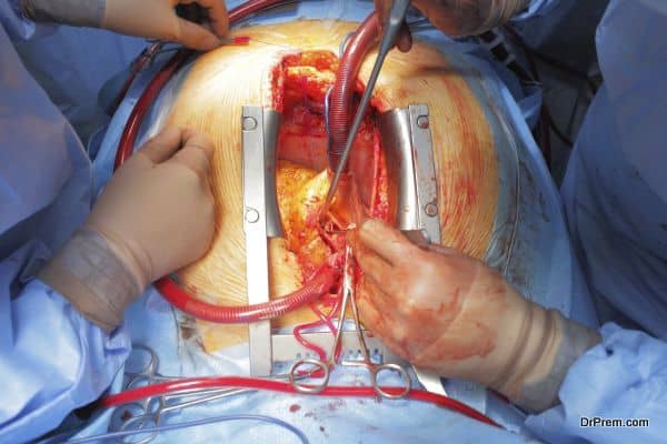 cardiac Surgery. An open wound.