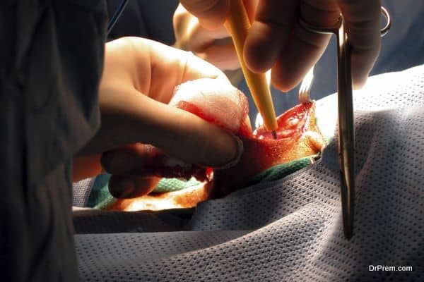 Vascular Surgeries1