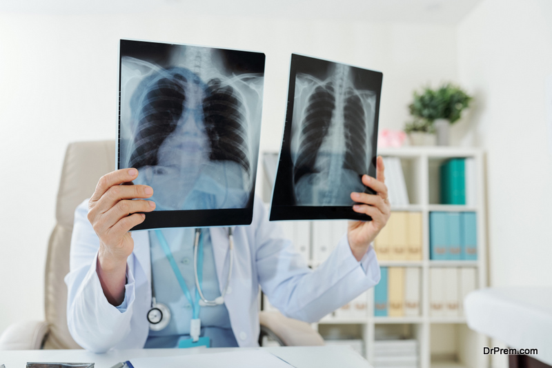 Doctor comparing two lungs x-rays of patient after his recovery
