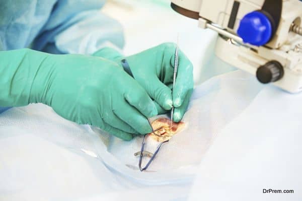 ophthalmology surgery. Surgeon's hands in gloves performing laser eye vision correction correction