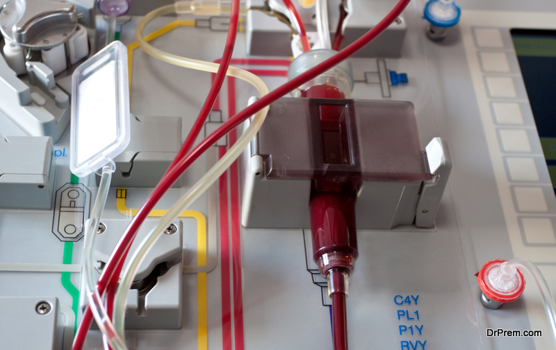 Close-up of medical machine device for stem cells transplantation