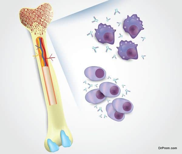 Bone Marrow Transplant (1)