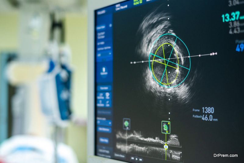 Intravascular ultrasound imaging (IVUS) at cardiac catheterization laboratory room