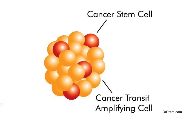 Medical Procedures - Cancer Stem Cell